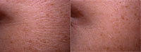 V�k: 22 let