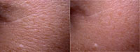 V�k: 23 let