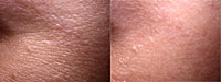 V�k: 24 let