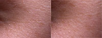 V�k: 26 let