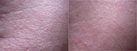 V�k: 28 let
